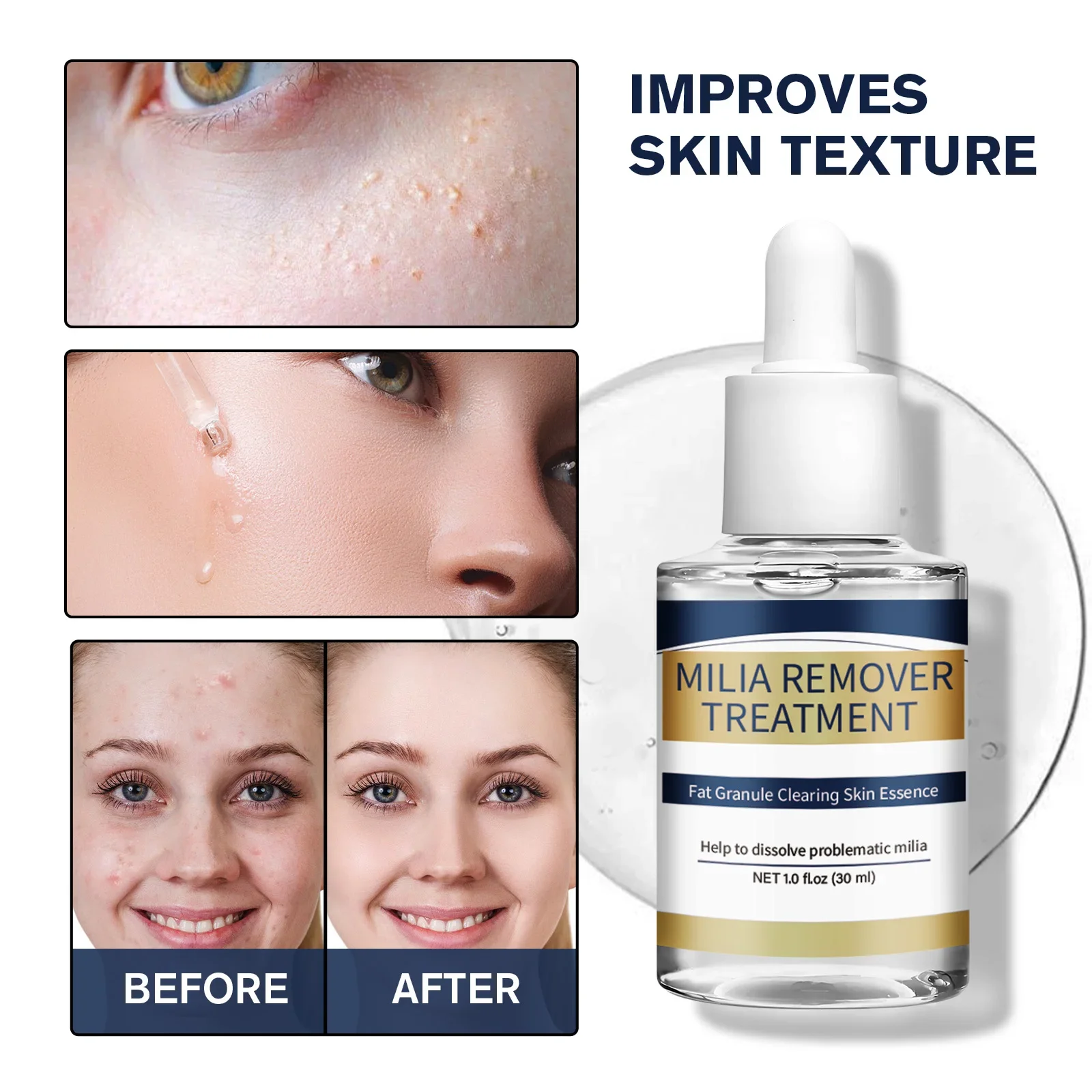 Hyaluronic Acid Serum - Eliminador de Milia, tratamiento de esencia,