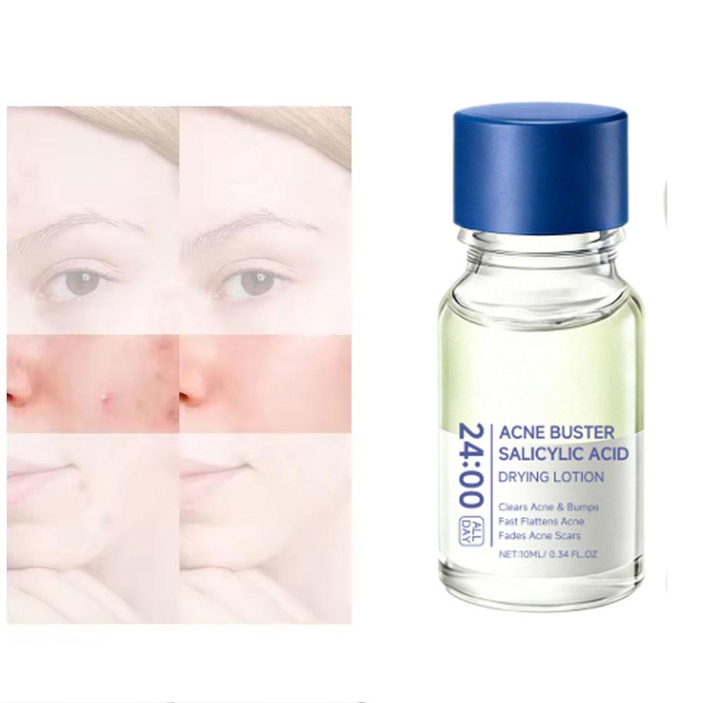 Loción de Tratamiento con Ácid - Hyaluronic Acid Serum reseña y precio