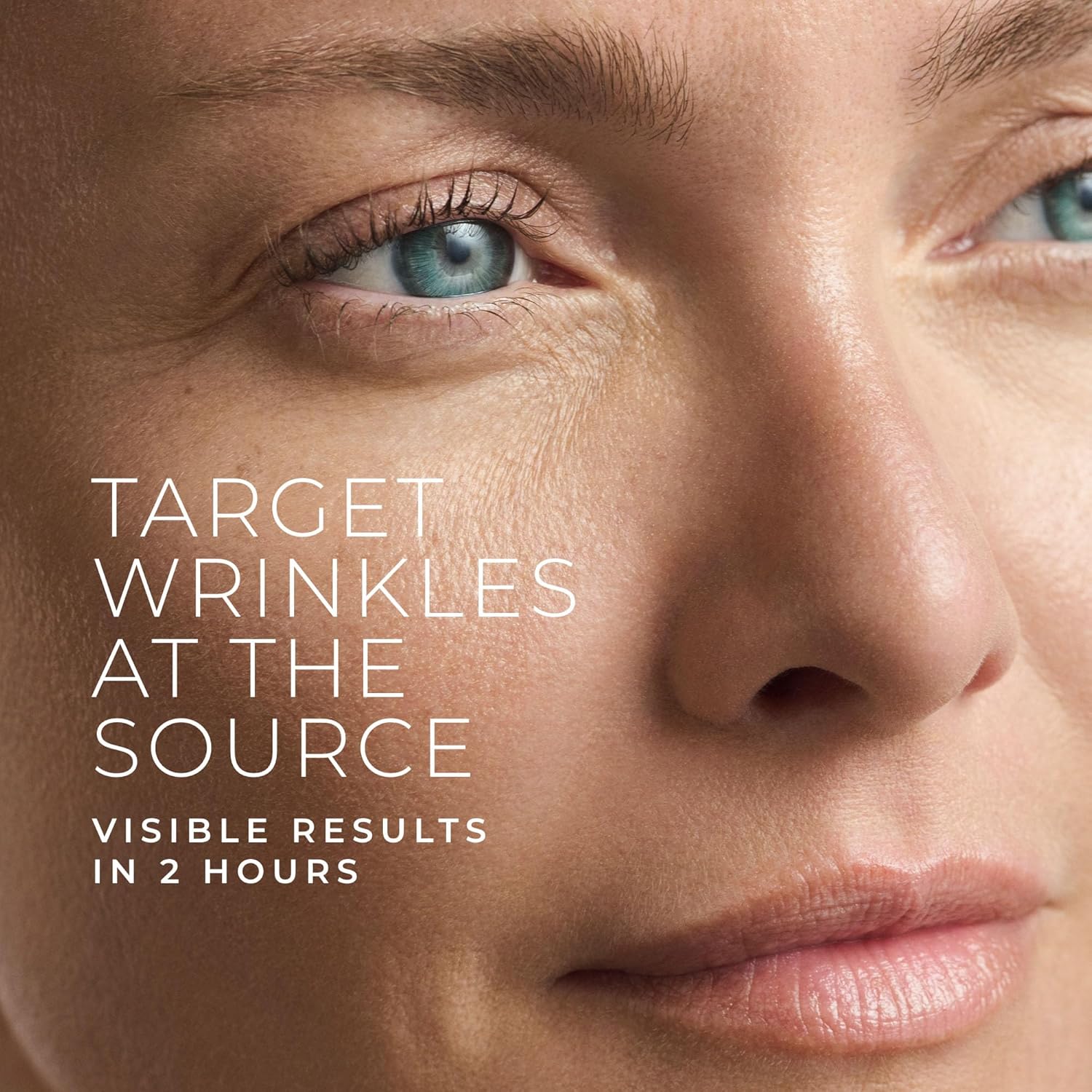 Parches de microagujas con ret - Skincare Acne reseña y precio